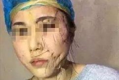 吃瓜抖音网红整容,吃瓜群众热议的美丽蜕变