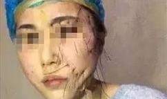 吃瓜抖音网红整容,吃瓜群众热议的美丽蜕变