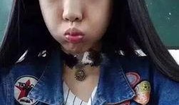 吃瓜抖音网红整容,吃瓜群众热议的美丽蜕变